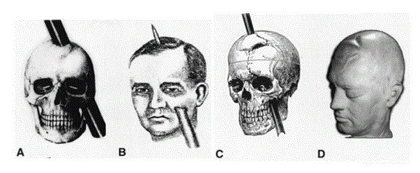 ilustraciones del incidente de phineas gage